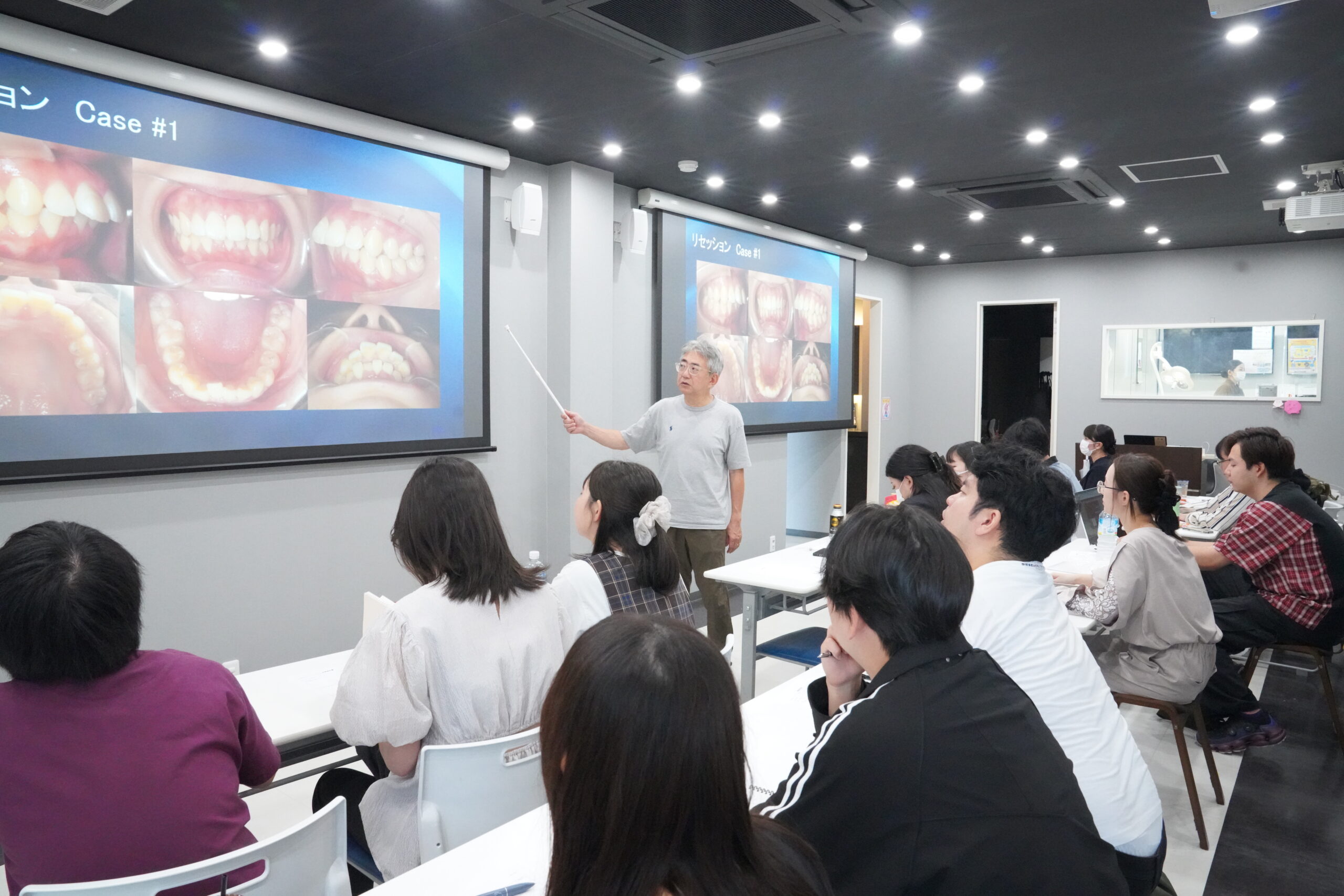 【歯科医師院内セミナー】実症例から学ぶクリアコレクトの治療計画とリスク管理
